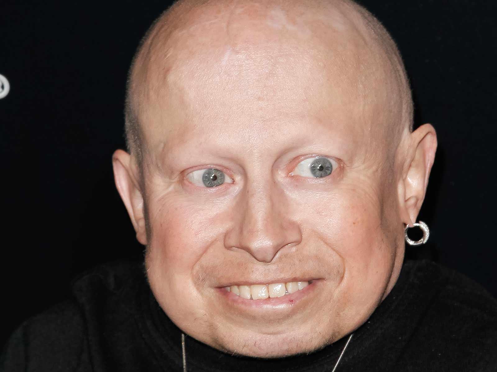 Verne Troyer Death Ruled Suicide, Drank Himself to Death