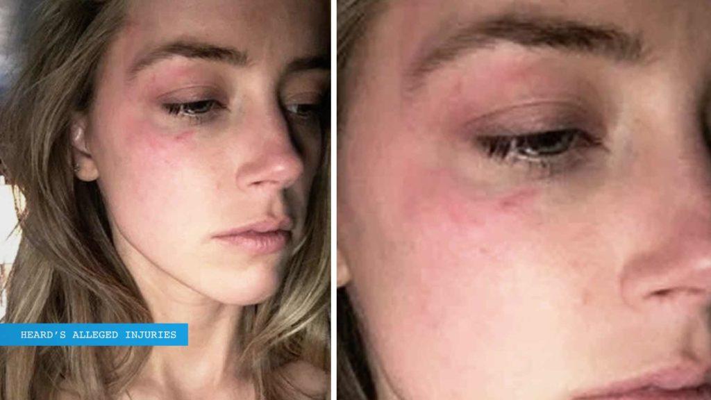 LAPD Officer Testifies She Saw 'No Injuries' On Amber Heard's Face