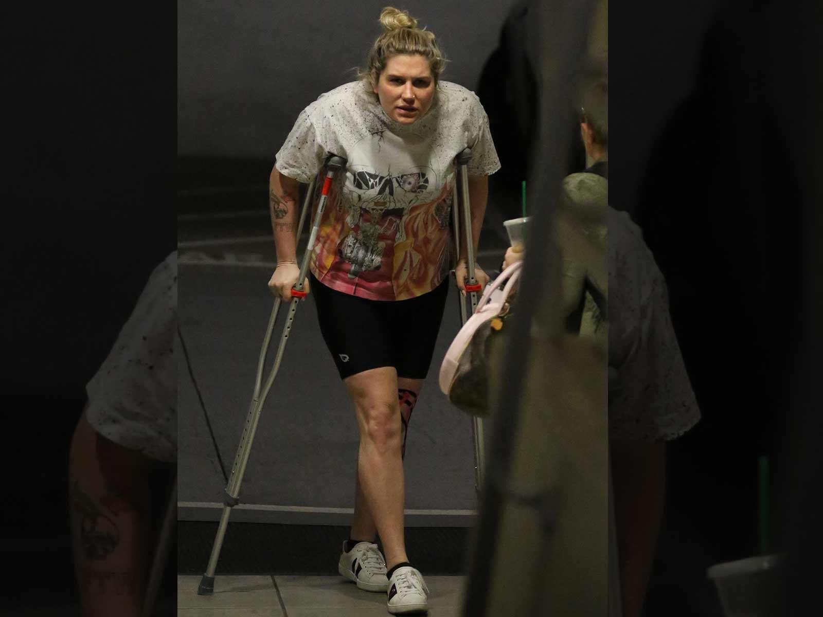 Kesha Seen on Crutches After Knee Surgery The Blast