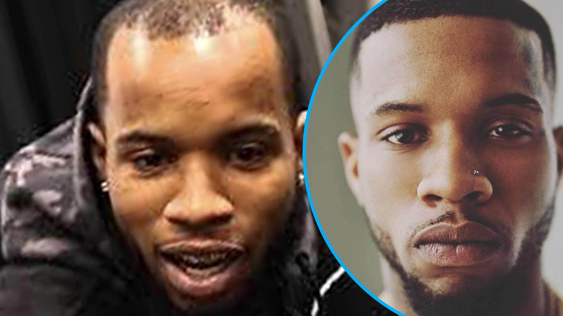 Tory Lanez Hairline Controversy, Expert Speaks Out - The Blast