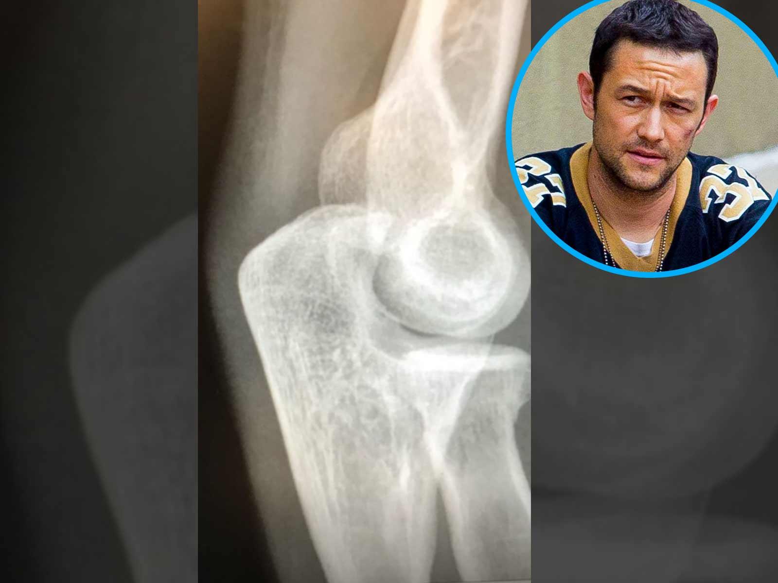 Joseph GordonLevitt Injured After Bicycle Crash On Set of 'Power