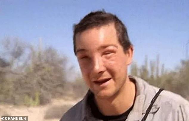 Bear Grylls Went Into Anaphylactic Shock While Filming And Had To Be Saved By Medics