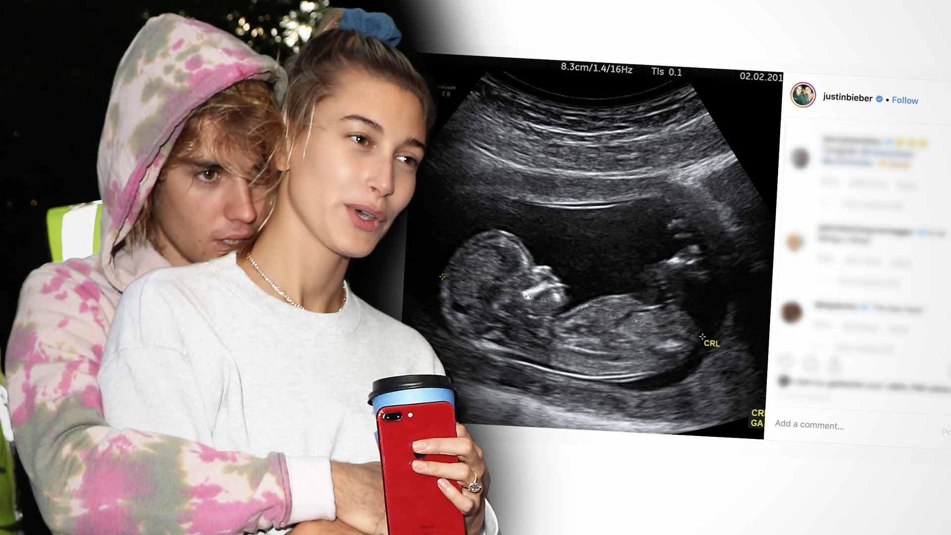 Justin Bieber Pulled His Ultrasound Announcement Picture from Wikipedia -  The Blast